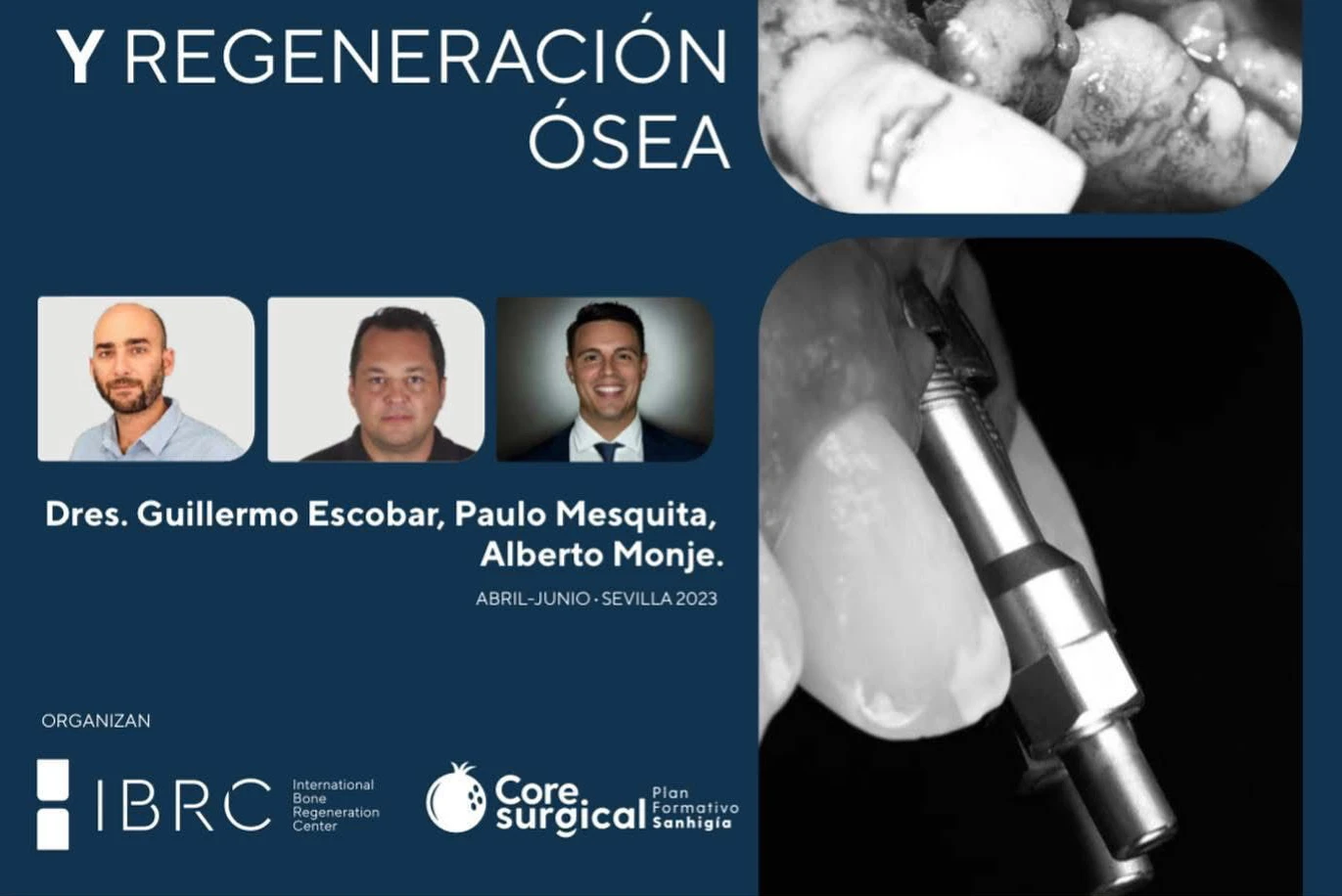 Curso Cirugía Mucogingival y Regeneración Ósea IBRC