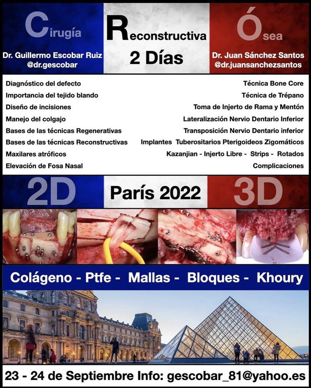 Curso Cirugía Ósea Reconstructiva con Dr. Juan Sánchez - París 2022