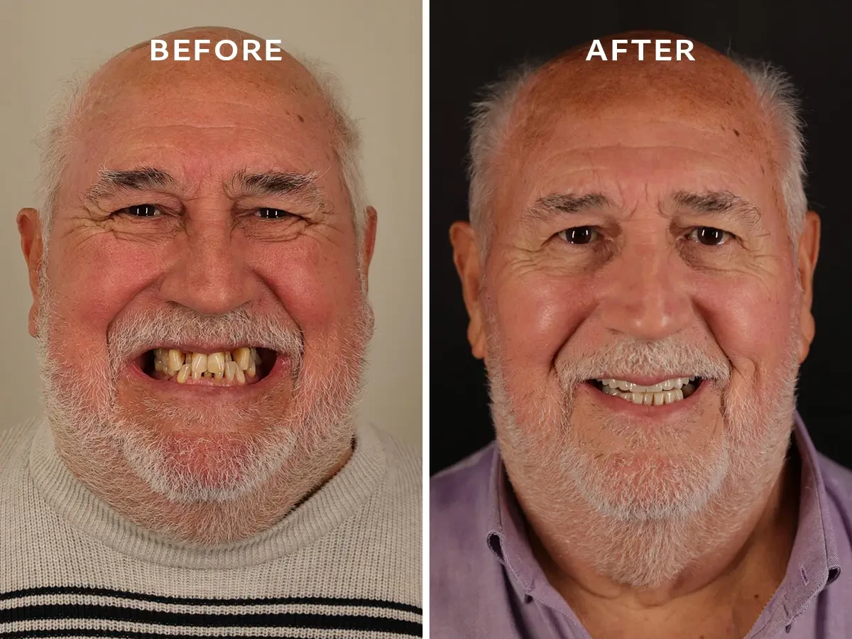Patient Edu - Dr Guillermo Escobar Ruiz