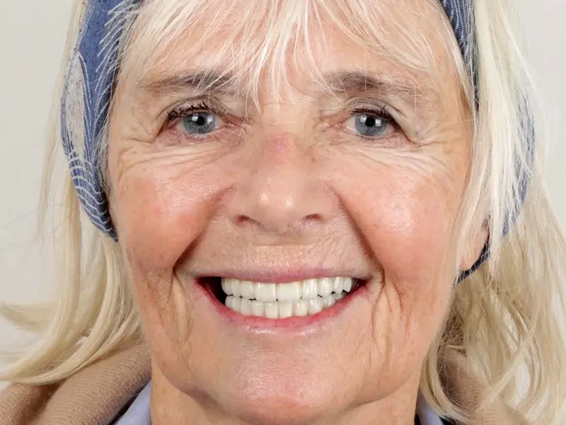 Patient Smiling - Dr Guillermo Escobar