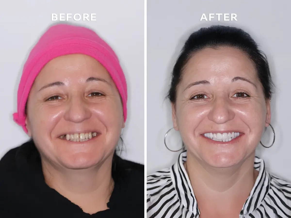 Patient Valentina - Dr Guillermo Escobar