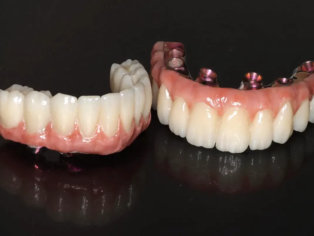 Zircone Implants - Dr Guillermo Escobar Ruiz