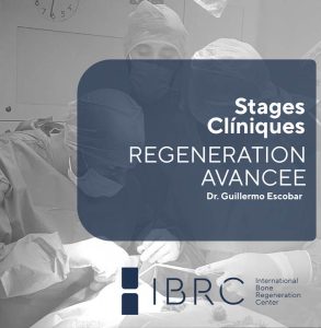 Stage clinique · Régénération avancée